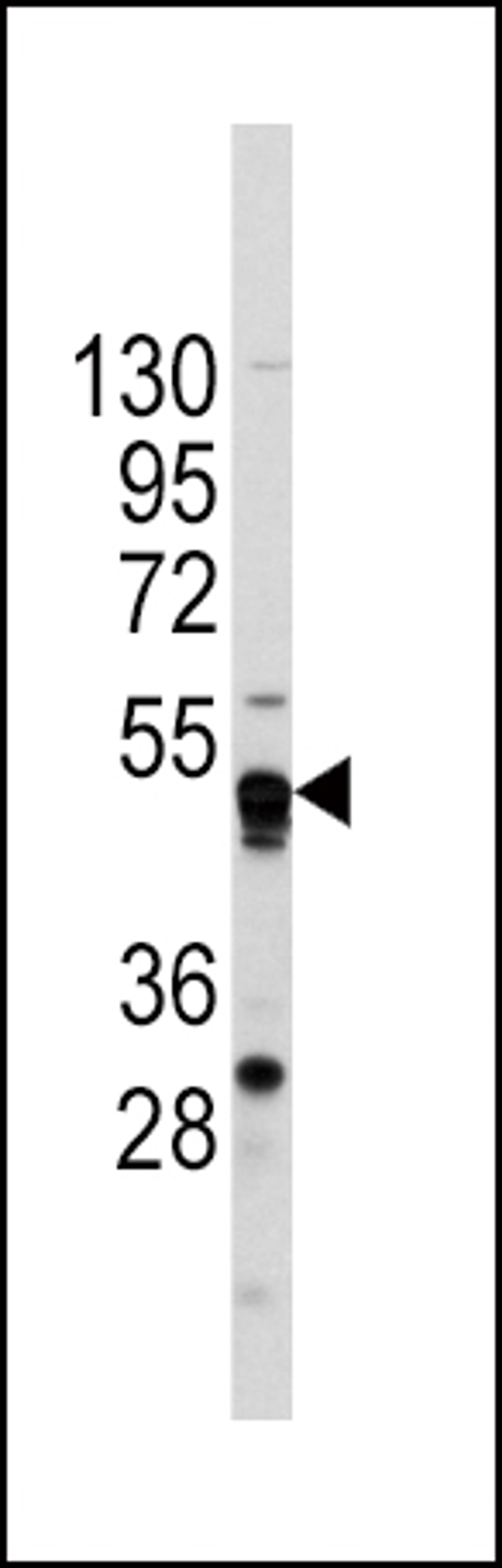 Western blot analysis of anti-GATA4 Antibody in CEM cell line lysates (35ug/lane).