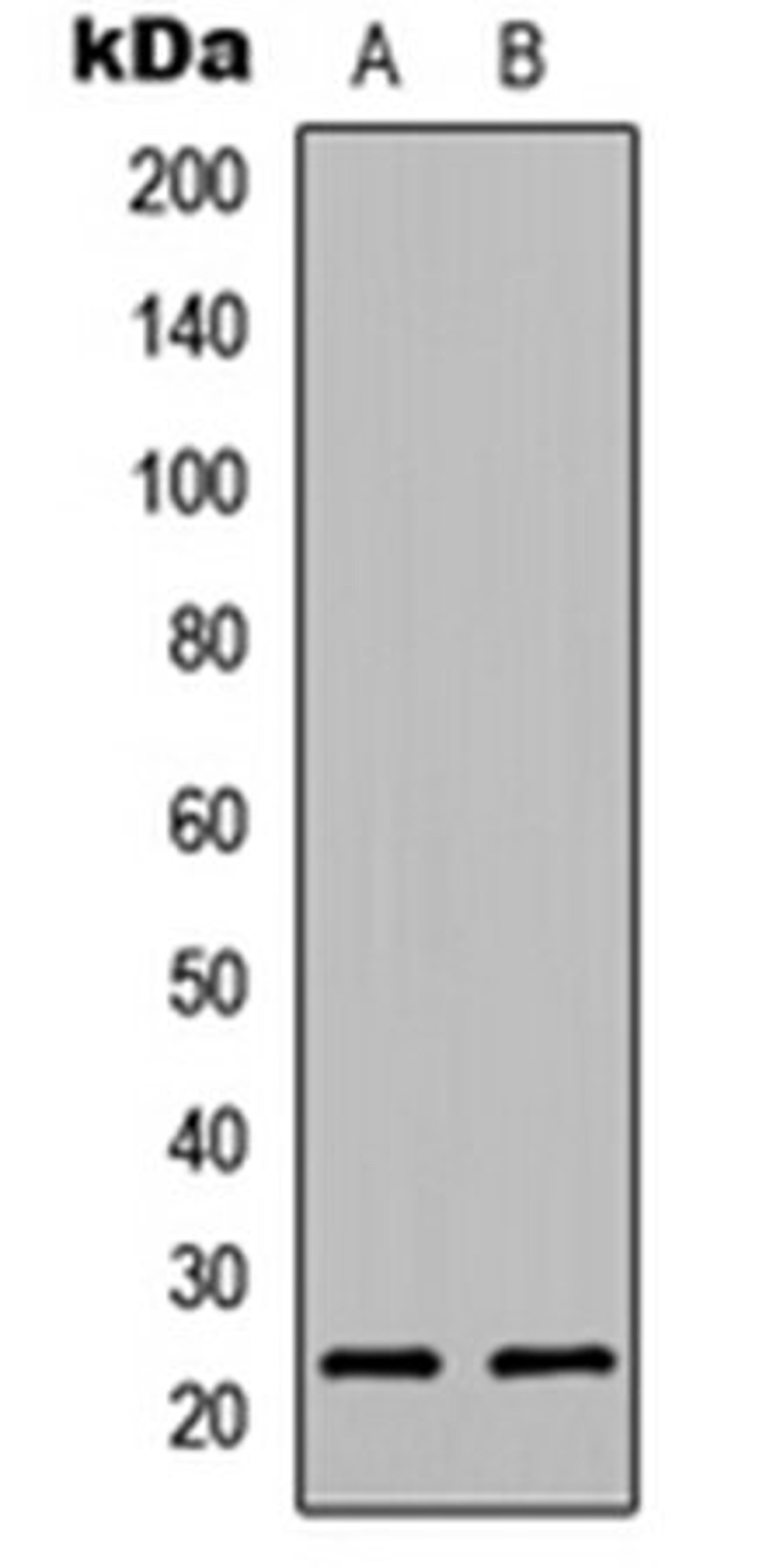 Western blot analysis of Jurkat (Lane 1), NIH3T3 (Lane 2) whole cell lysates using p23 antibody