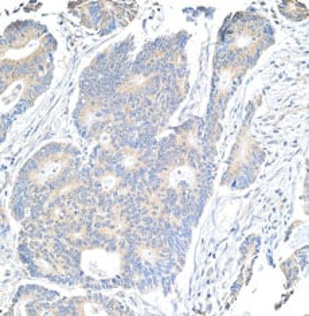 Detection of human Notch1 by immunohistochemistry.