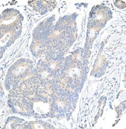 Detection of human Notch1 by immunohistochemistry.