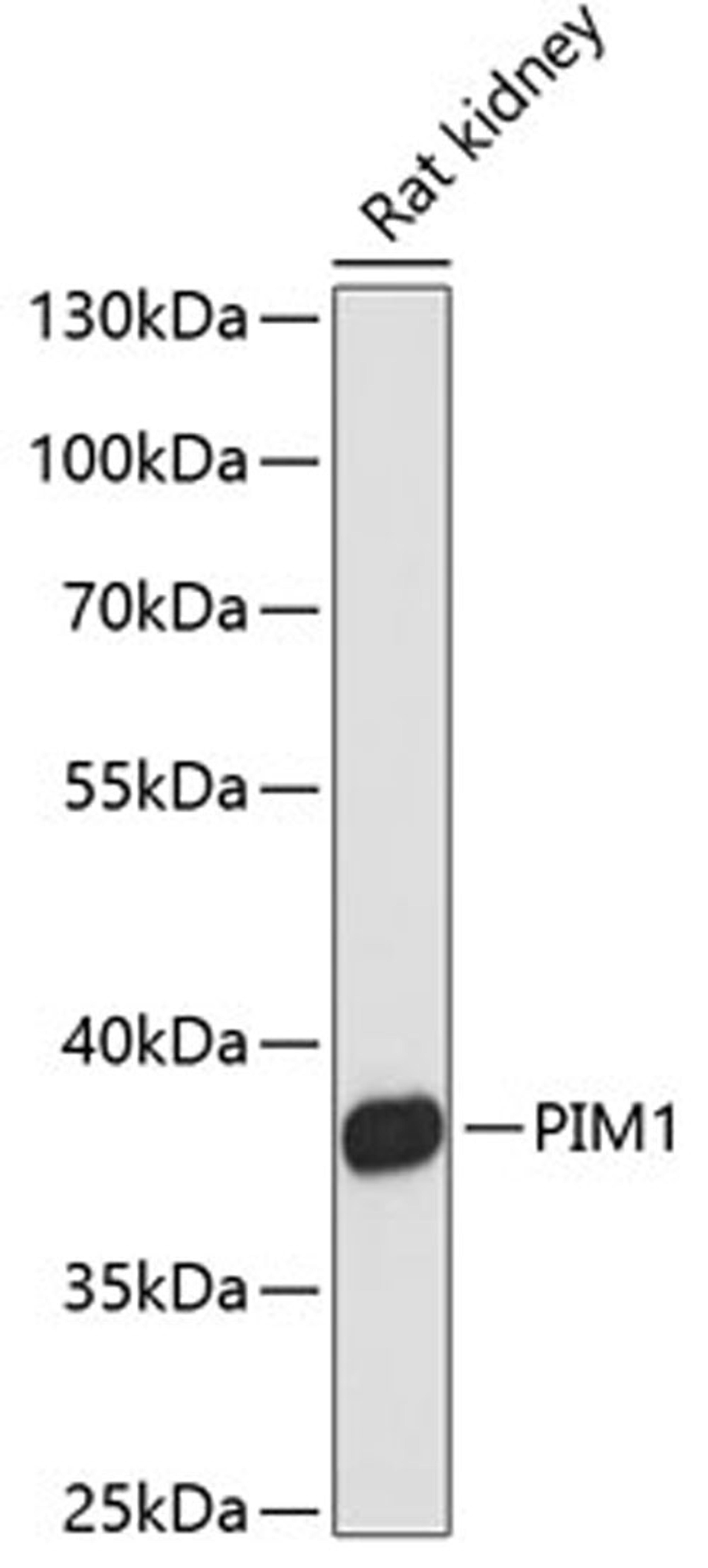 Western blot - PIM1 antibody (A0175)