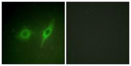 Immunocytochemistry/Immunofluorescence: COL4A2 Antibody [NBP1-68266] - Analysis of HeLa cells, using COL4A2 Antibody. The picture on the right is treated with the synthesized peptide.