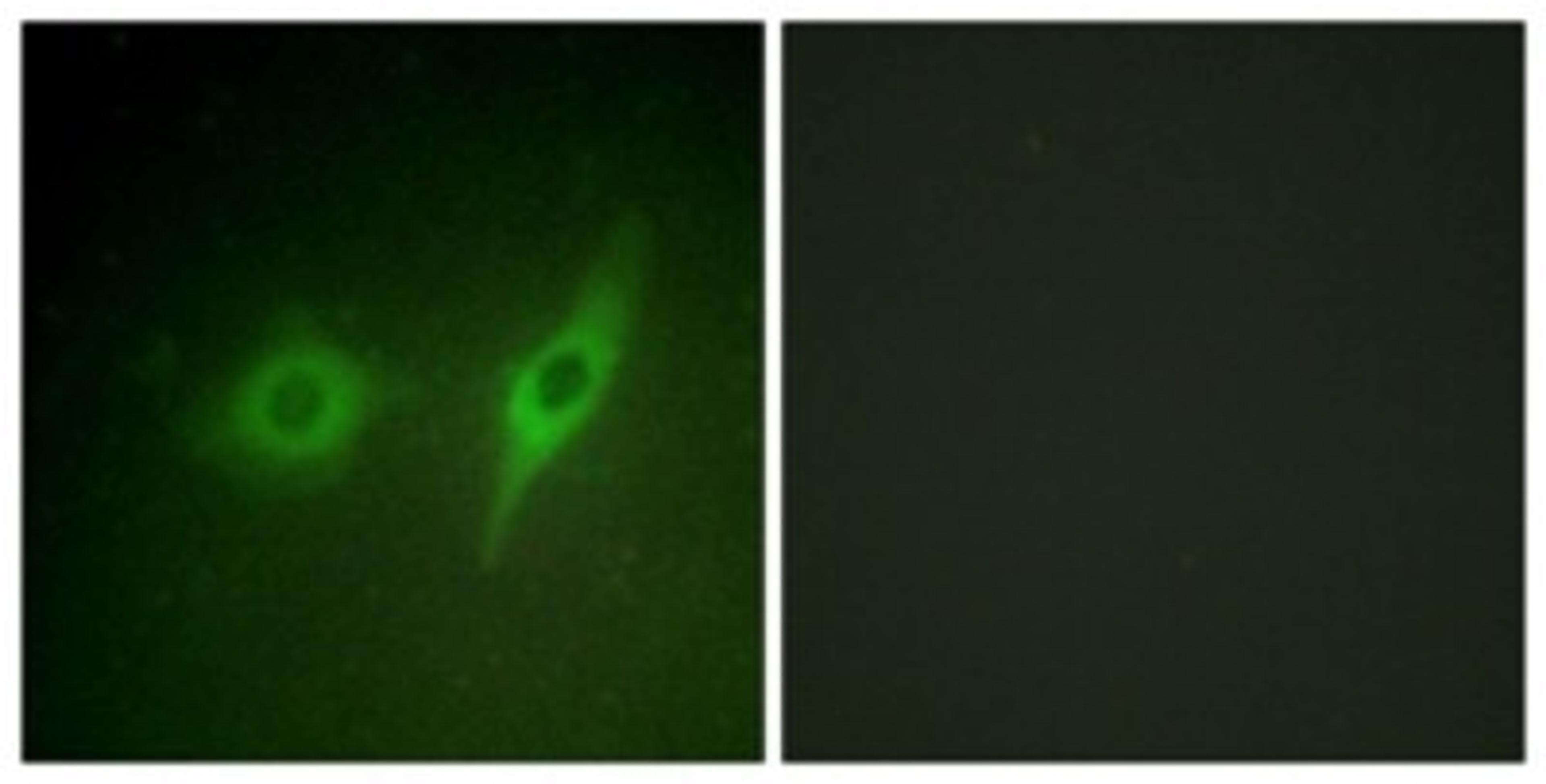 Immunocytochemistry/Immunofluorescence: COL4A2 Antibody [NBP1-68266] - Analysis of HeLa cells, using COL4A2 Antibody. The picture on the right is treated with the synthesized peptide.