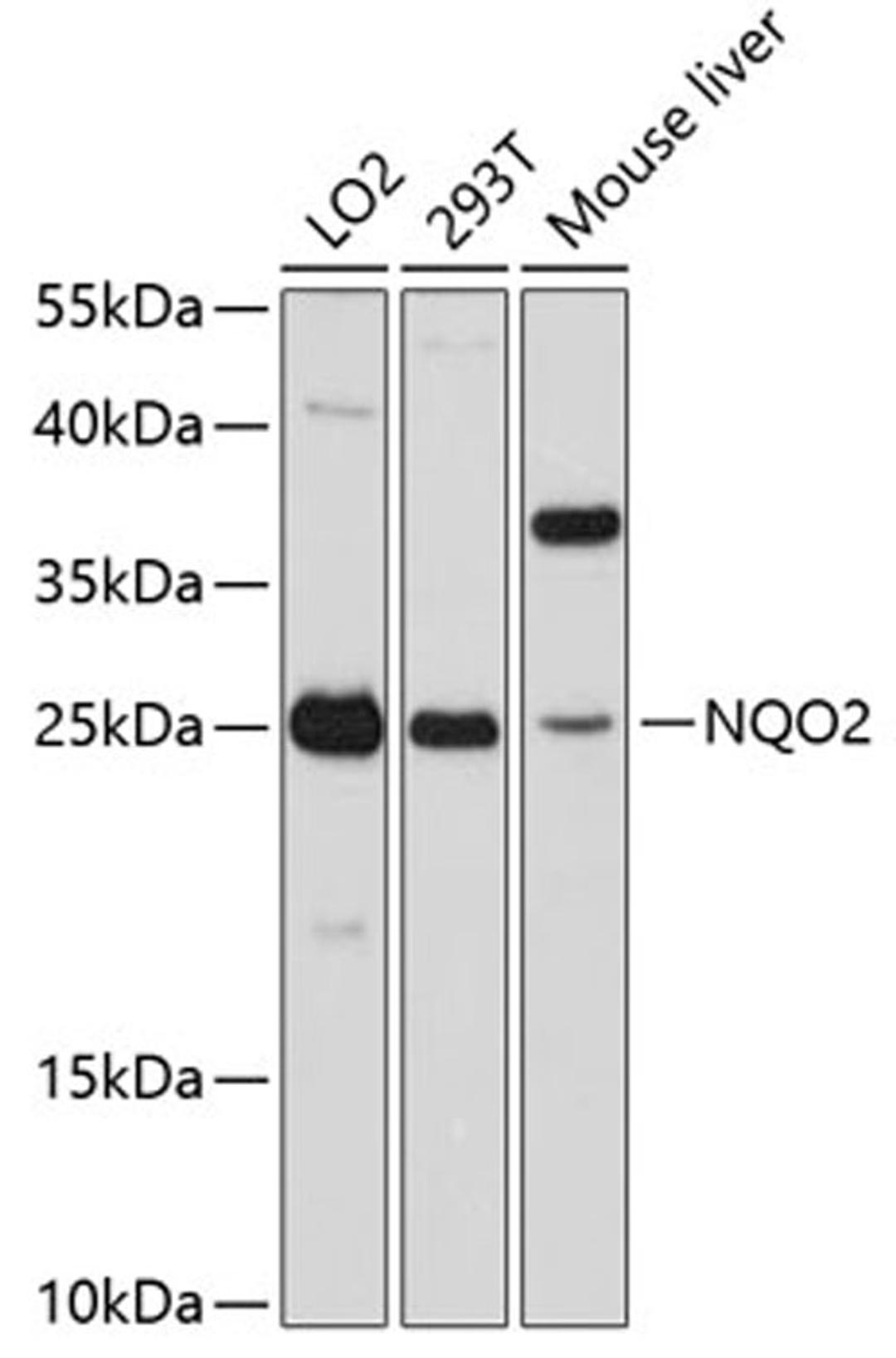 Western blot - NQO2 antibody (A11742)