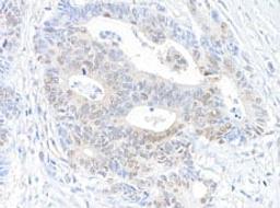 Detection of human RanBP1 by immunohistochemistry.