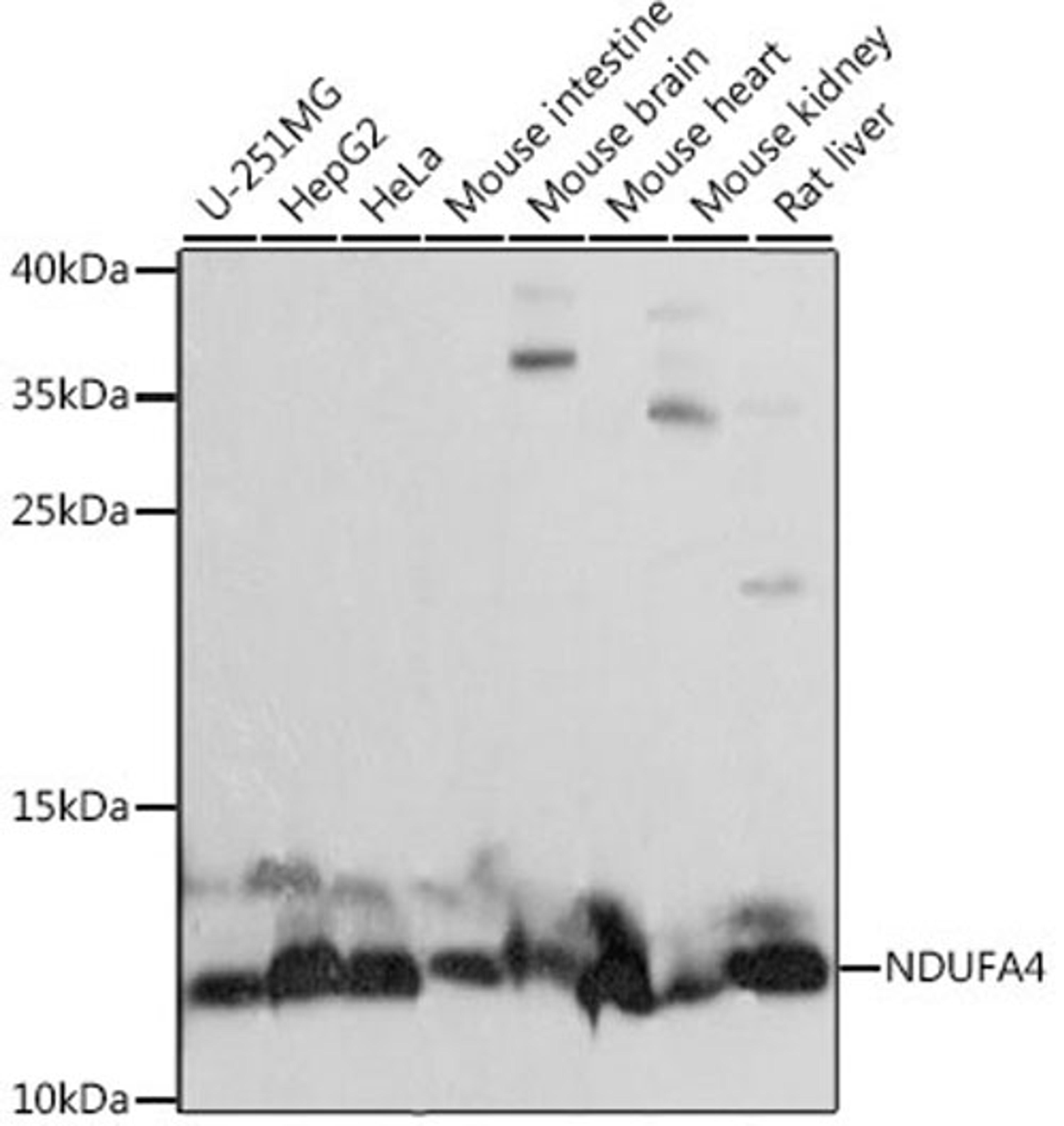 Western blot - NDUFA4 antibody (A15693)