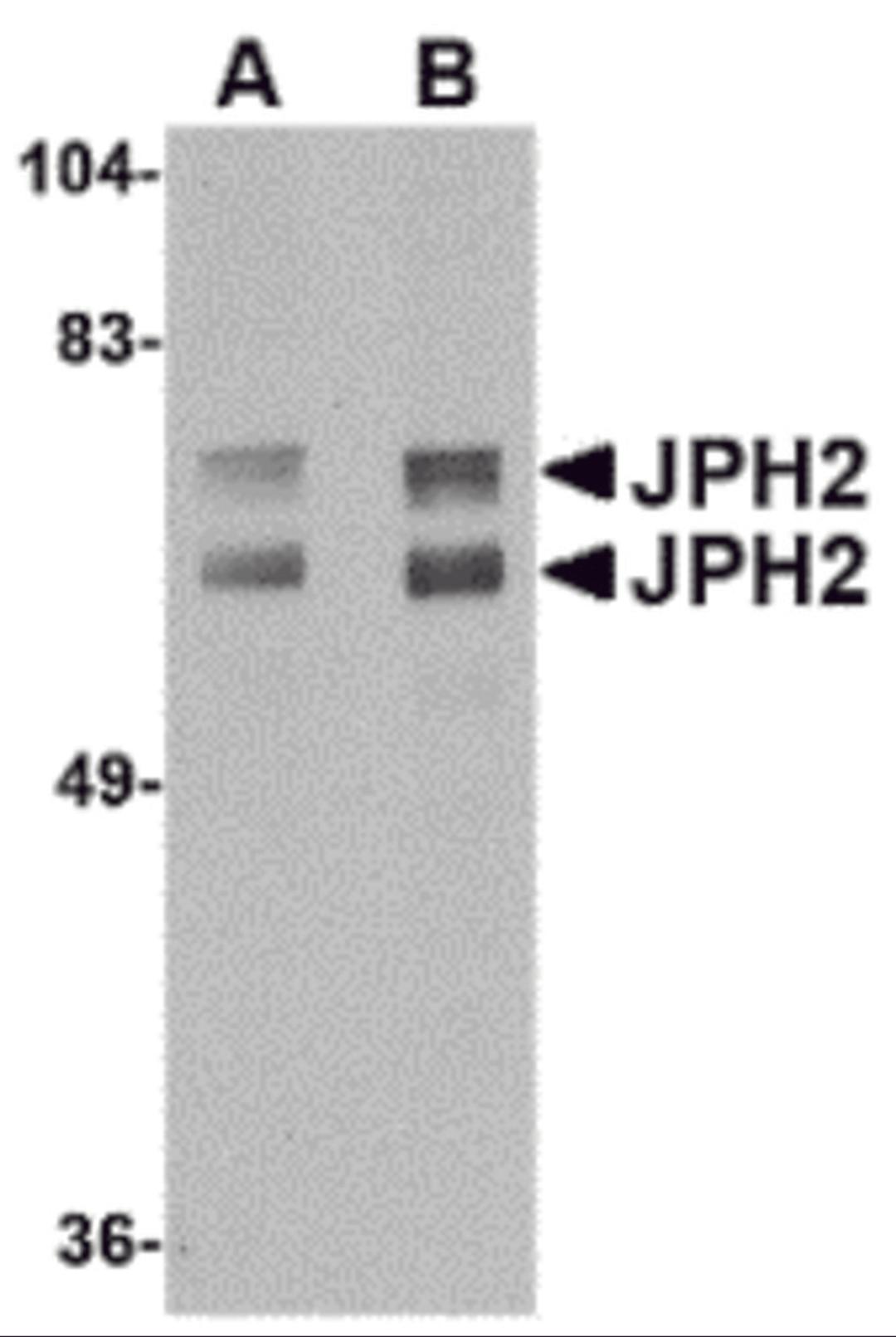 Western blot analysis of JPH2 in mouse brain tissue lysate with JPH2 antibody at (A) 1 and (B) 2 μg/mL.