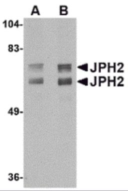 Western blot analysis of JPH2 in mouse brain tissue lysate with JPH2 antibody at (A) 1 and (B) 2 μg/mL.