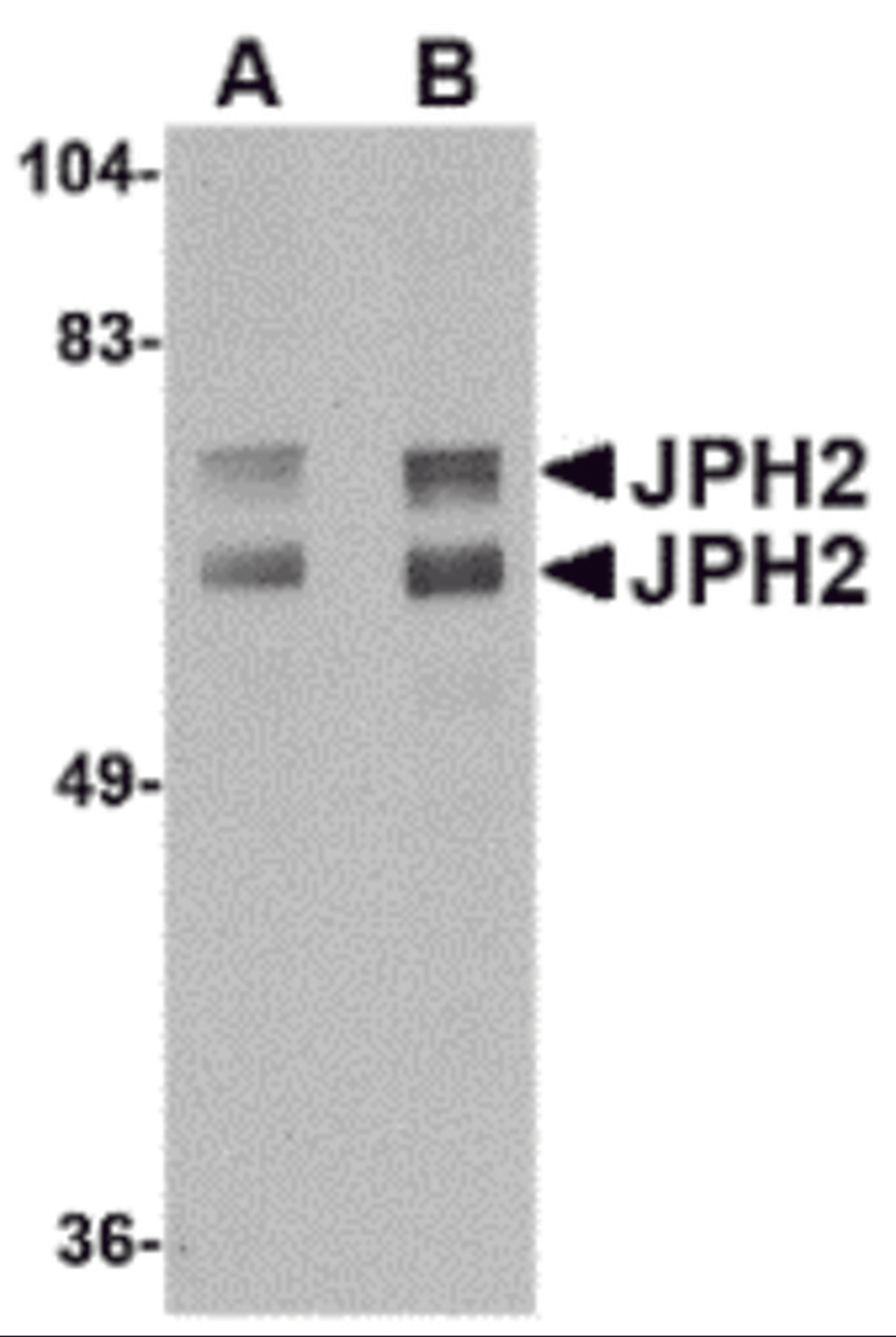 Western blot analysis of JPH2 in mouse brain tissue lysate with JPH2 antibody at (A) 1 and (B) 2 μg/mL.