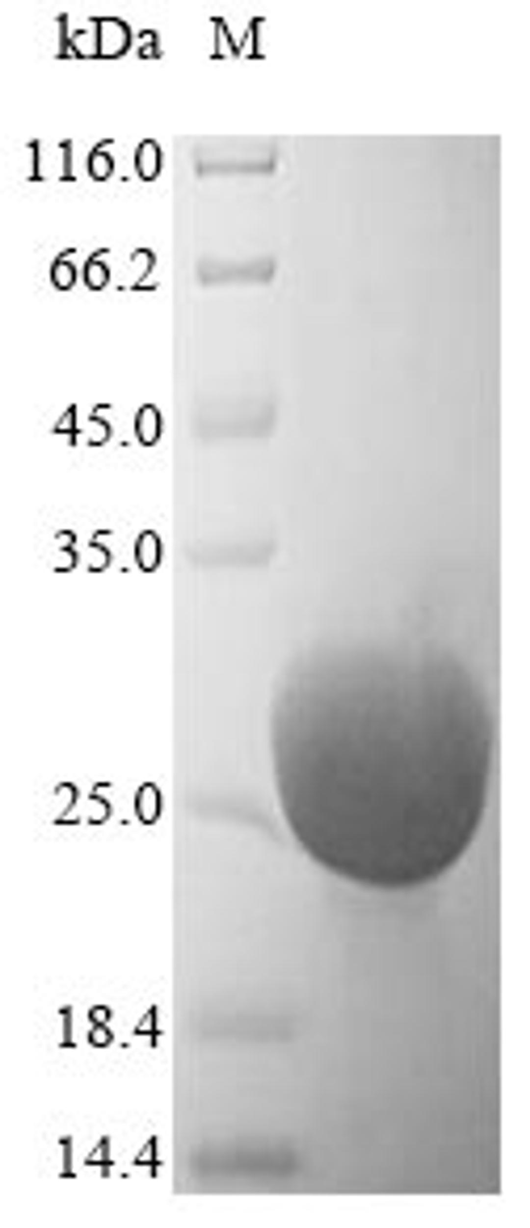 (Tris-Glycine gel) Discontinuous SDS-PAGE (reduced) with 5% enrichment gel and 15% separation gel.