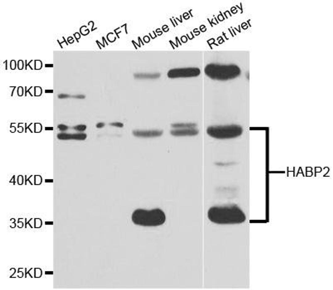 Western blot analysis of extracts of various cell lines using HABP2 antibody