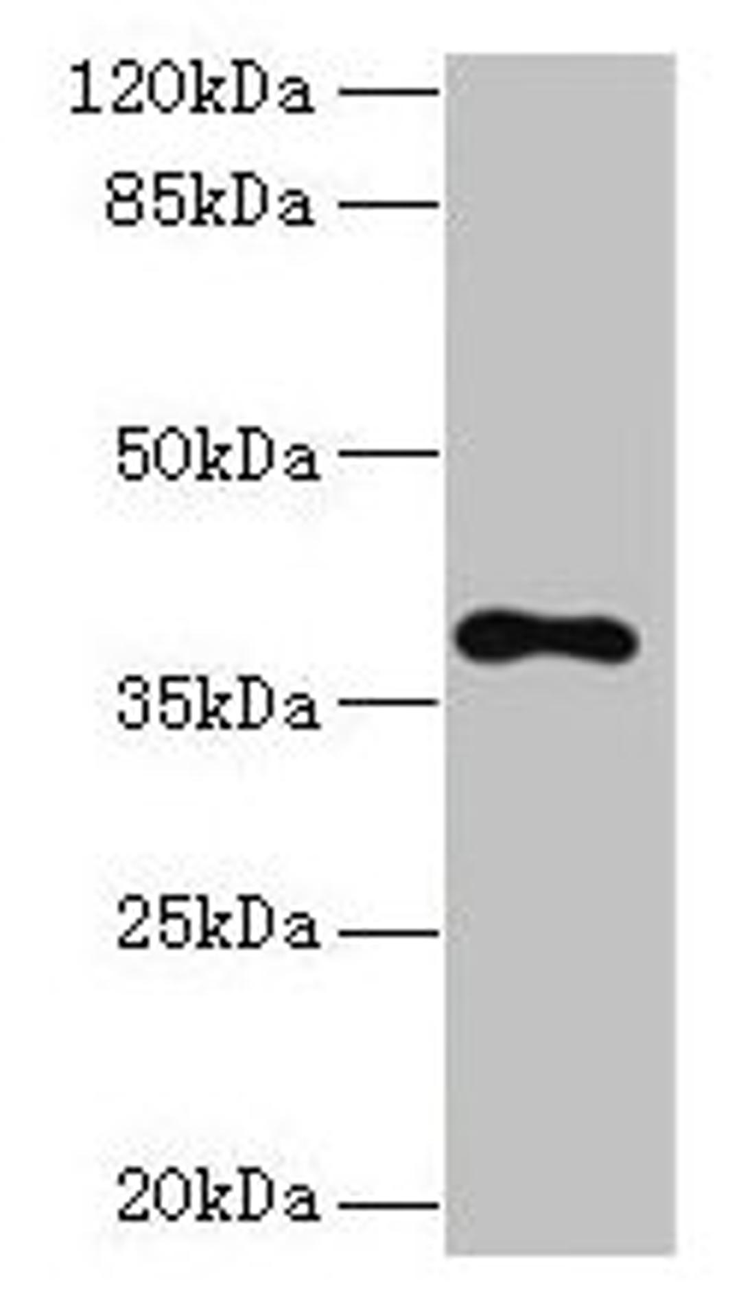 Western blot. All lanes: TMEM59L antibody at 3µg/ml + 293T whole cell lysate. Secondary. Goat polyclonal to rabbit IgG at 1/10000 dilution. Predicted band size: 38 kDa. Observed band size: 38 kDa