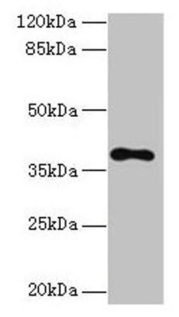 Western blot. All lanes: TMEM59L antibody at 3µg/ml + 293T whole cell lysate. Secondary. Goat polyclonal to rabbit IgG at 1/10000 dilution. Predicted band size: 38 kDa. Observed band size: 38 kDa