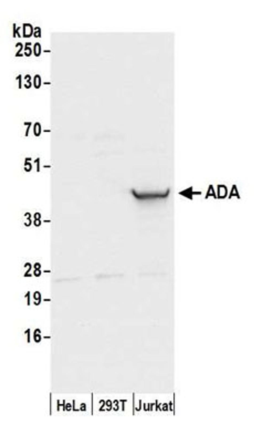 Detection of human ADA by western blot.