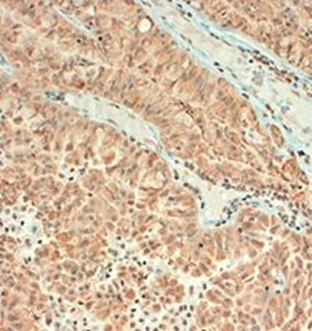 IHC-P of human brain neurons with lack of staining shown on the blood vessels using VAMP1 antibody