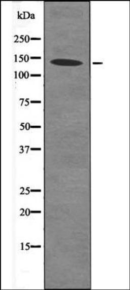 Western blot analysis of MDA-MB-435 whole cell lysates using eNOS -Phospho-Ser633- antibody