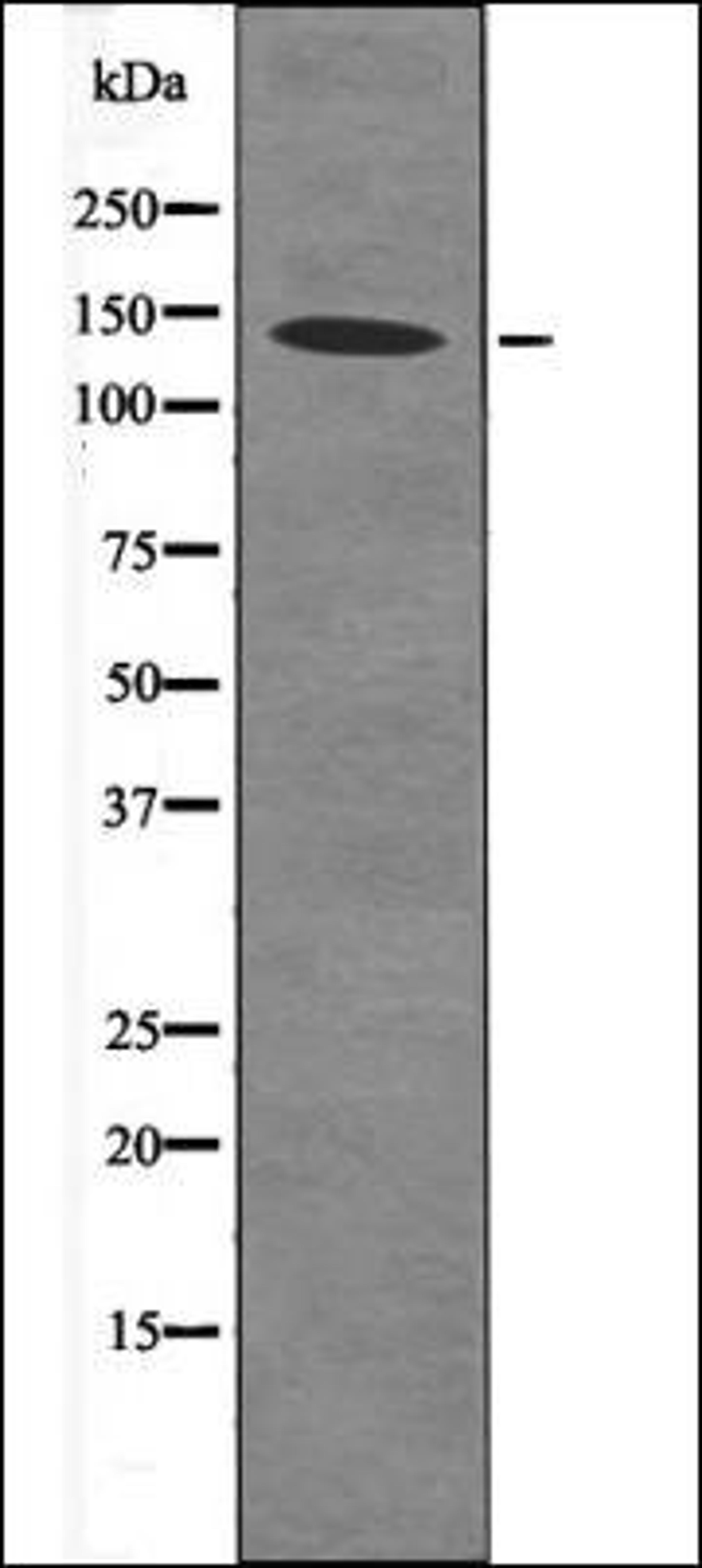 Western blot analysis of MDA-MB-435 whole cell lysates using eNOS -Phospho-Ser633- antibody