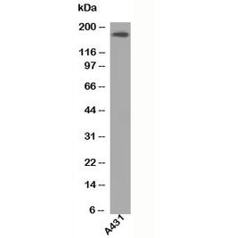 Western blot testing of A431 lysate using EGFR antibody at 1ug/ml.