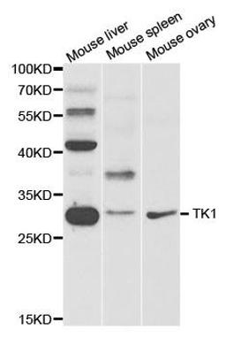 Western blot analysis of extracts of various cell lines using TK1 antibody