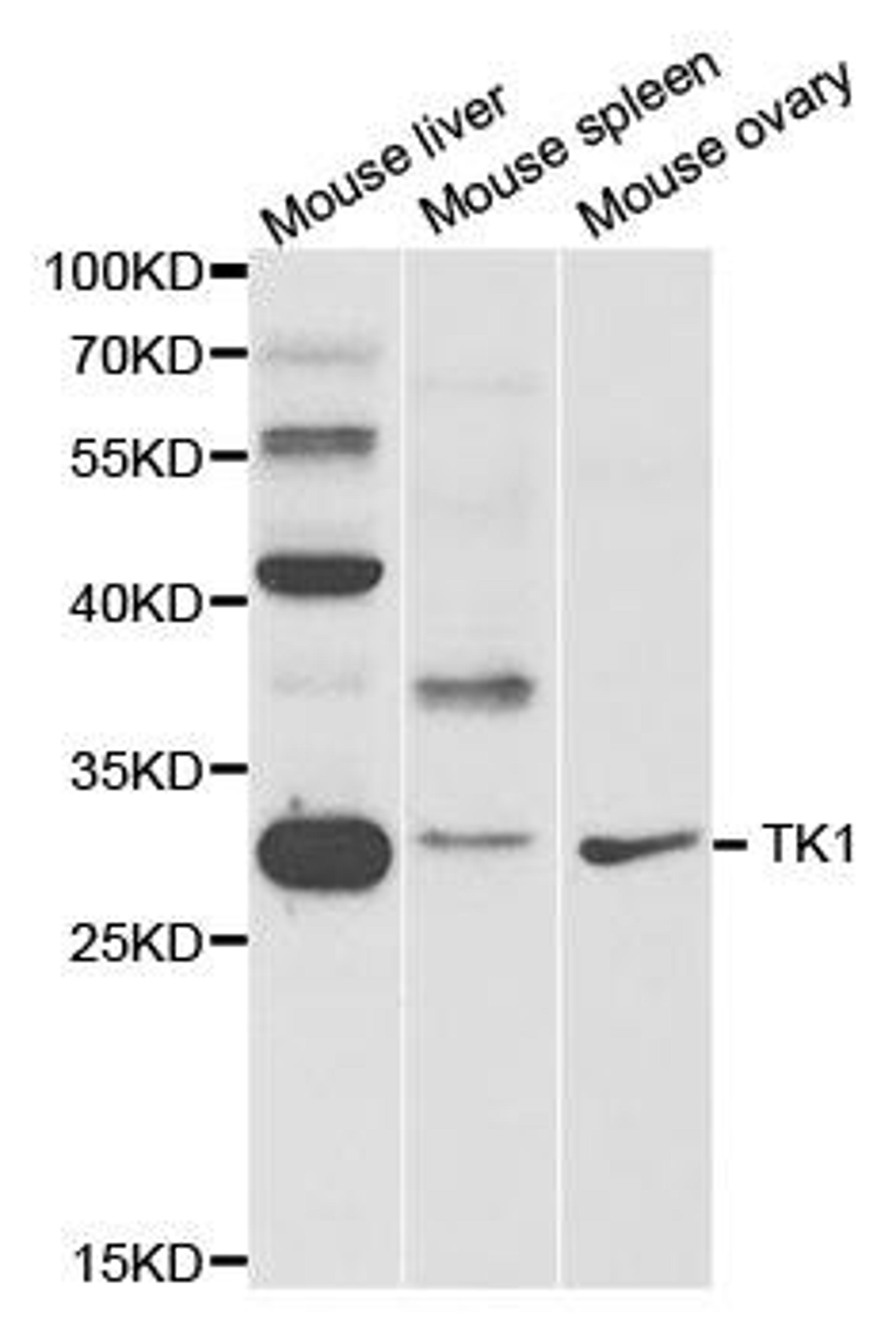 Western blot analysis of extracts of various cell lines using TK1 antibody