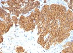 Immunohistochemistry-Paraffin: PTH Antibody  - IHC-prediluted [NBP2-48374] - Formalin-fixed paraffin embedded human Parathyroid.