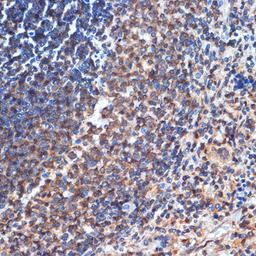 Immunohistochemistry - CD35 Rabbit mAb (A3661)