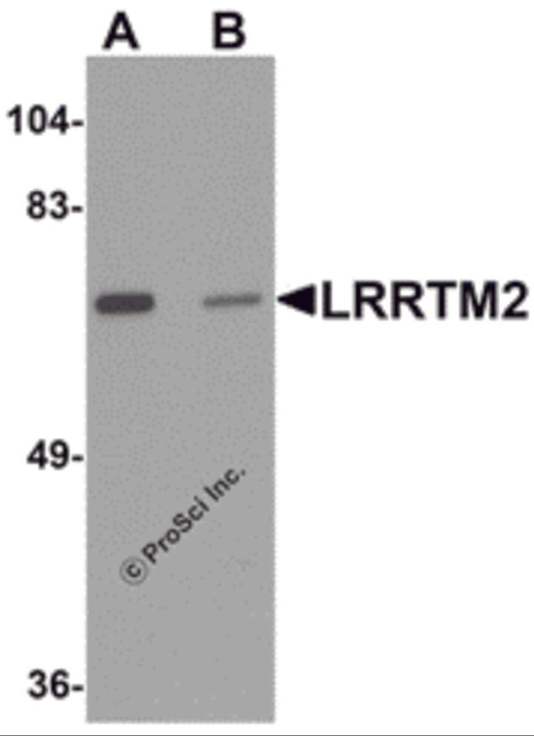 Western blot analysis of LRRTM2 in SK-N-SH cell lysate with LRRTM2 antibody at 1 μg/mL in (A) the absence and (B) the presence of blocking peptide.