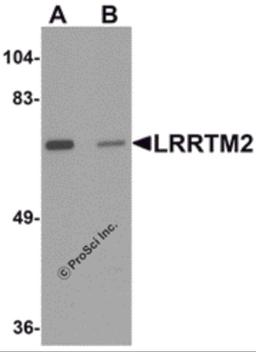 Western blot analysis of LRRTM2 in SK-N-SH cell lysate with LRRTM2 antibody at 1 μg/mL in (A) the absence and (B) the presence of blocking peptide.