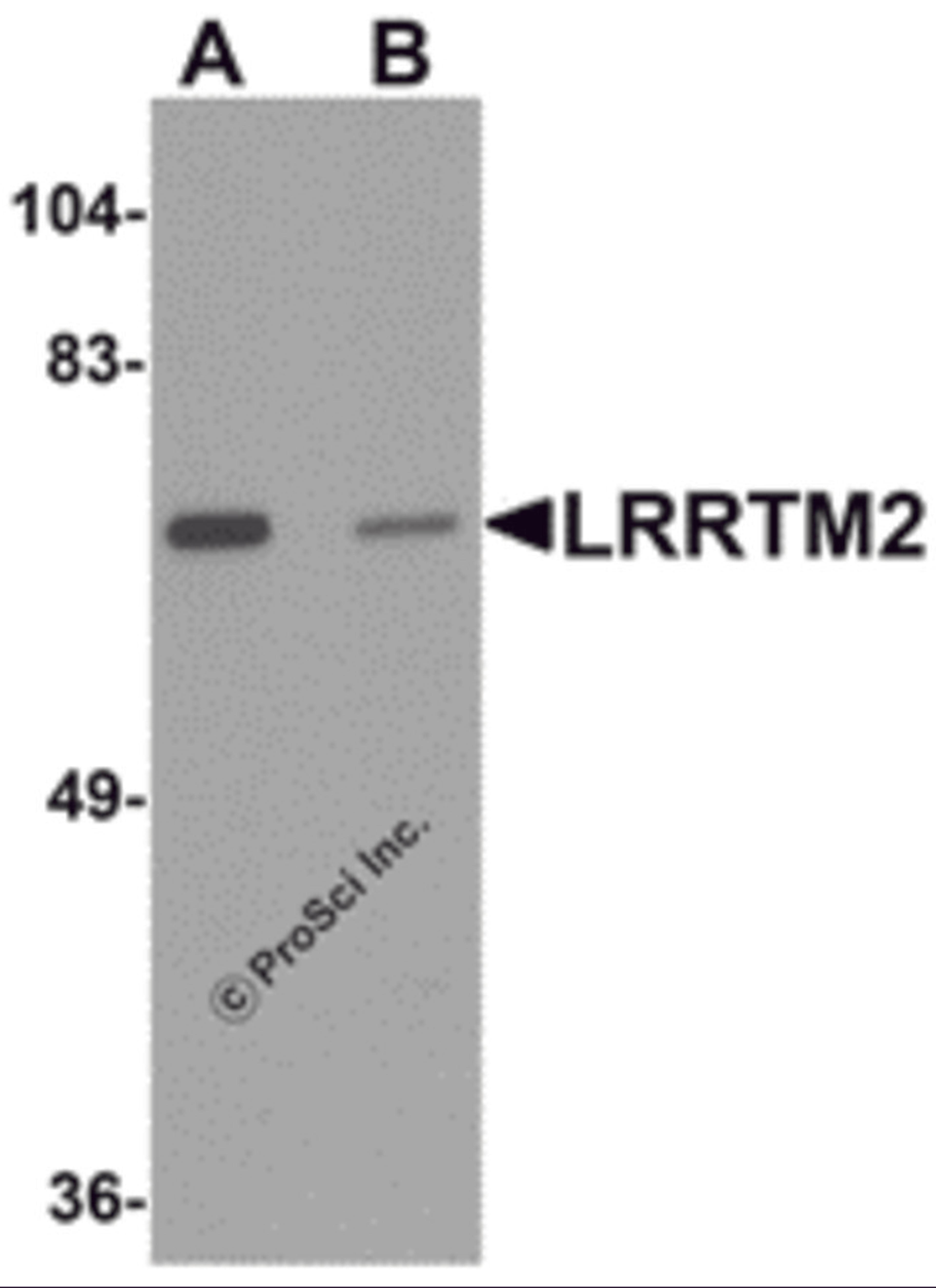 Western blot analysis of LRRTM2 in SK-N-SH cell lysate with LRRTM2 antibody at 1 μg/mL in (A) the absence and (B) the presence of blocking peptide.
