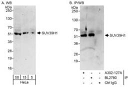 Detection of human SUV39H1 by western blot and immunoprecipitation.