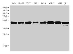 Western Blot. Positive WB detected in: Hela whole cell lysate, HepG2 whole cell lysate, SY5Y whole cell lysate, 293 whole cell lysate, PC-3 whole cell lysate, MCF-7 whole cell lysate, A549 whole cell lysate, JK whole cell lysate. All lanes: PARD6G antibody at 1:1000. Secondary. Goat polyclonal to rabbit IgG at 1/50000 dilution. Predicted band size: 41, 13 kDa. Observed band size: 41 kDa. 