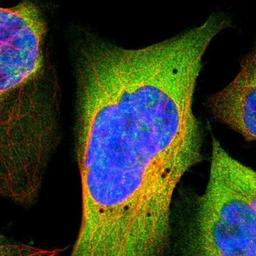 Immunocytochemistry/Immunofluorescence: PYGL Antibody [NBP1-86182] - Staining of human cell line U-2 OS shows positivity in plasma membrane & cytoplasm.