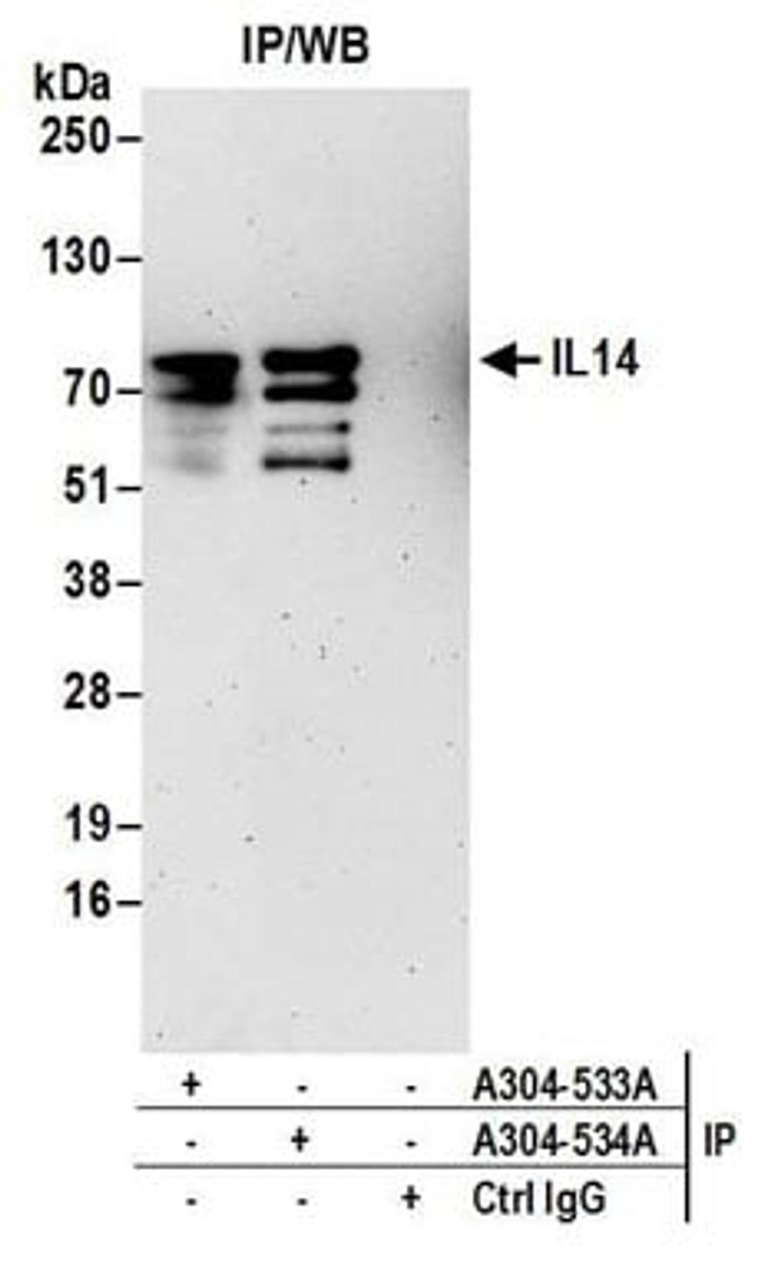 Detection of human IL14 by western blot of immunoprecipitates.