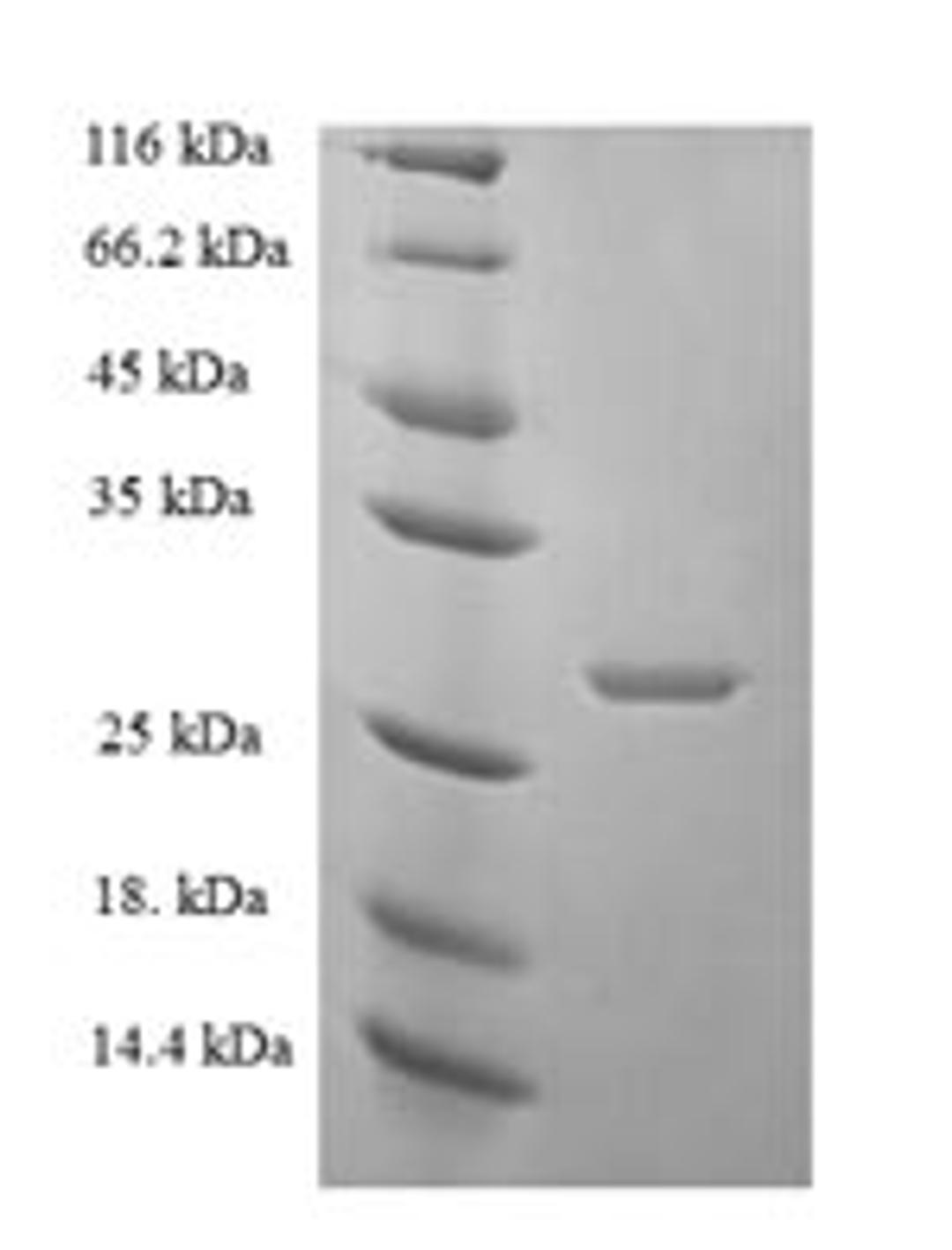 (Tris-Glycine gel) Discontinuous SDS-PAGE (reduced) with 5% enrichment gel and 15% separation gel.
