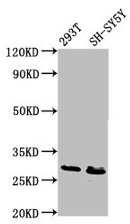 Western Blot. Positive WB detected in: 293T whole cell lysate, SH-SY5Y whole cell lysate. All lanes: RFXANK antibody at 6.7ug/ml. Secondary. Goat polyclonal to rabbit IgG at 1/50000 dilution. Predicted band size: 29, 25, 26 kDa. Observed band size: 29 kDa.