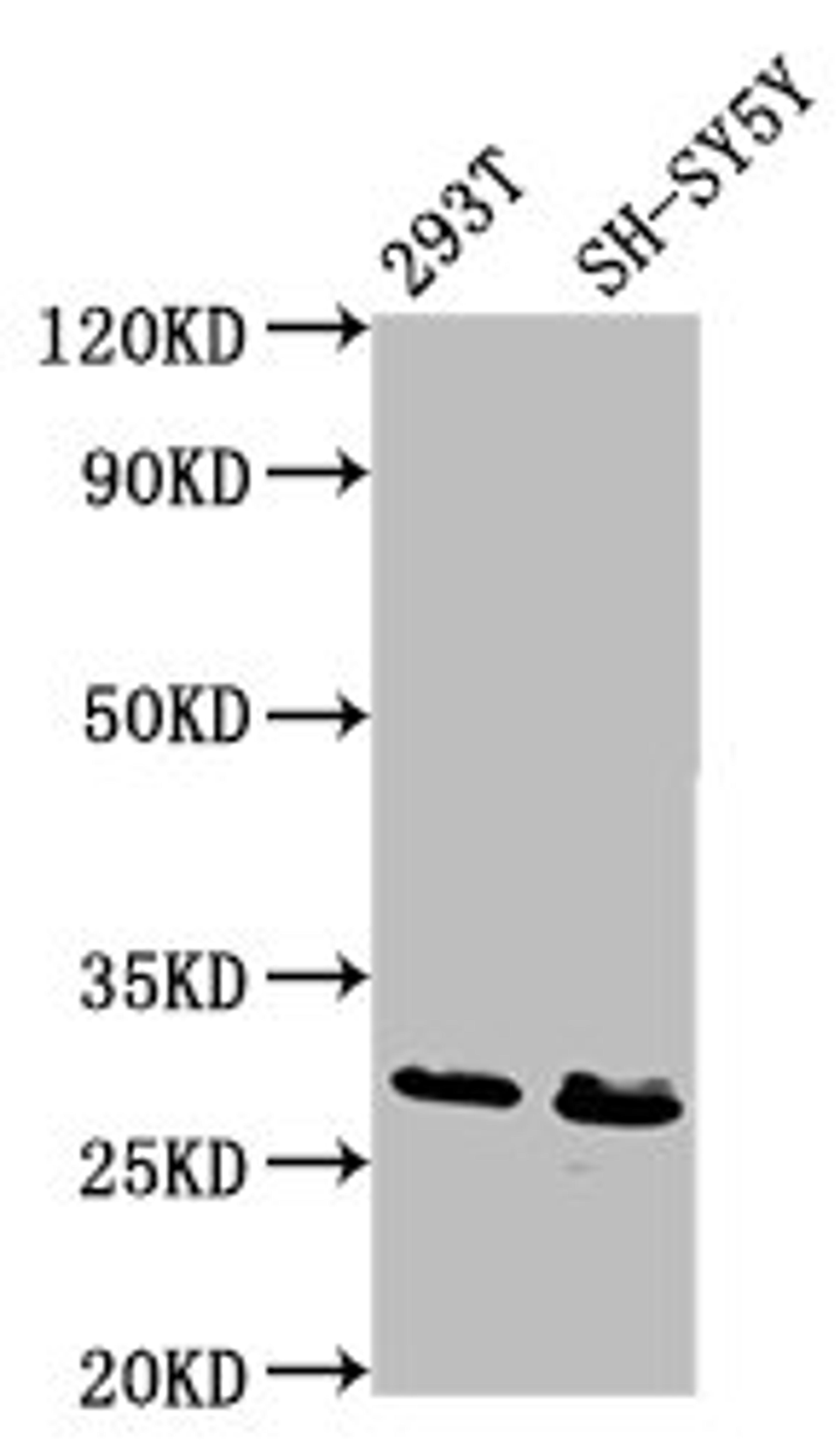Western Blot. Positive WB detected in: 293T whole cell lysate, SH-SY5Y whole cell lysate. All lanes: RFXANK antibody at 6.7ug/ml. Secondary. Goat polyclonal to rabbit IgG at 1/50000 dilution. Predicted band size: 29, 25, 26 kDa. Observed band size: 29 kDa.