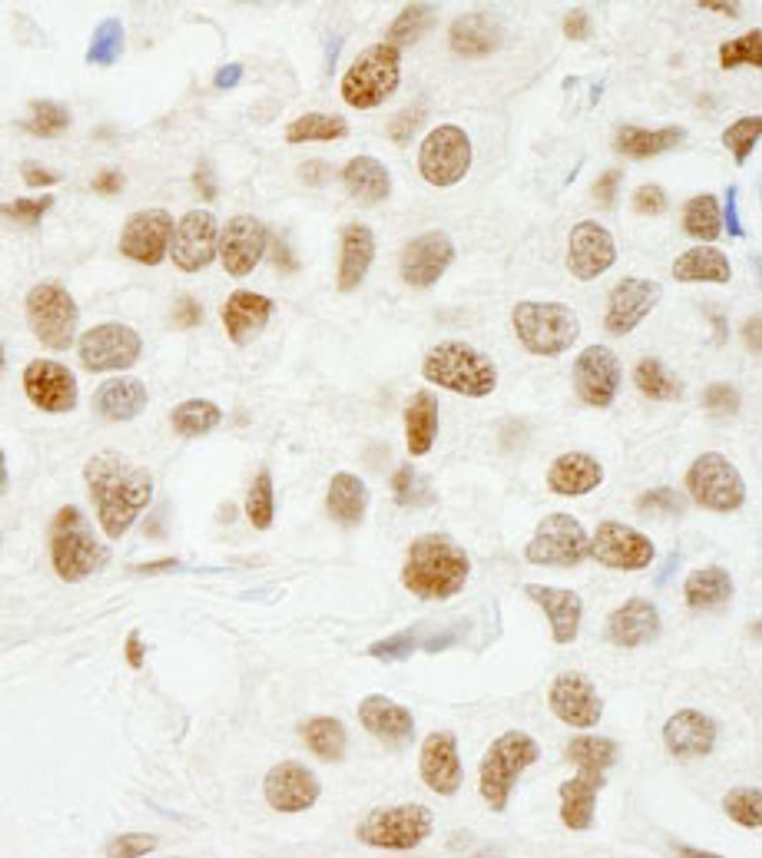 Detection of human SAM68 by immunohistochemistry.