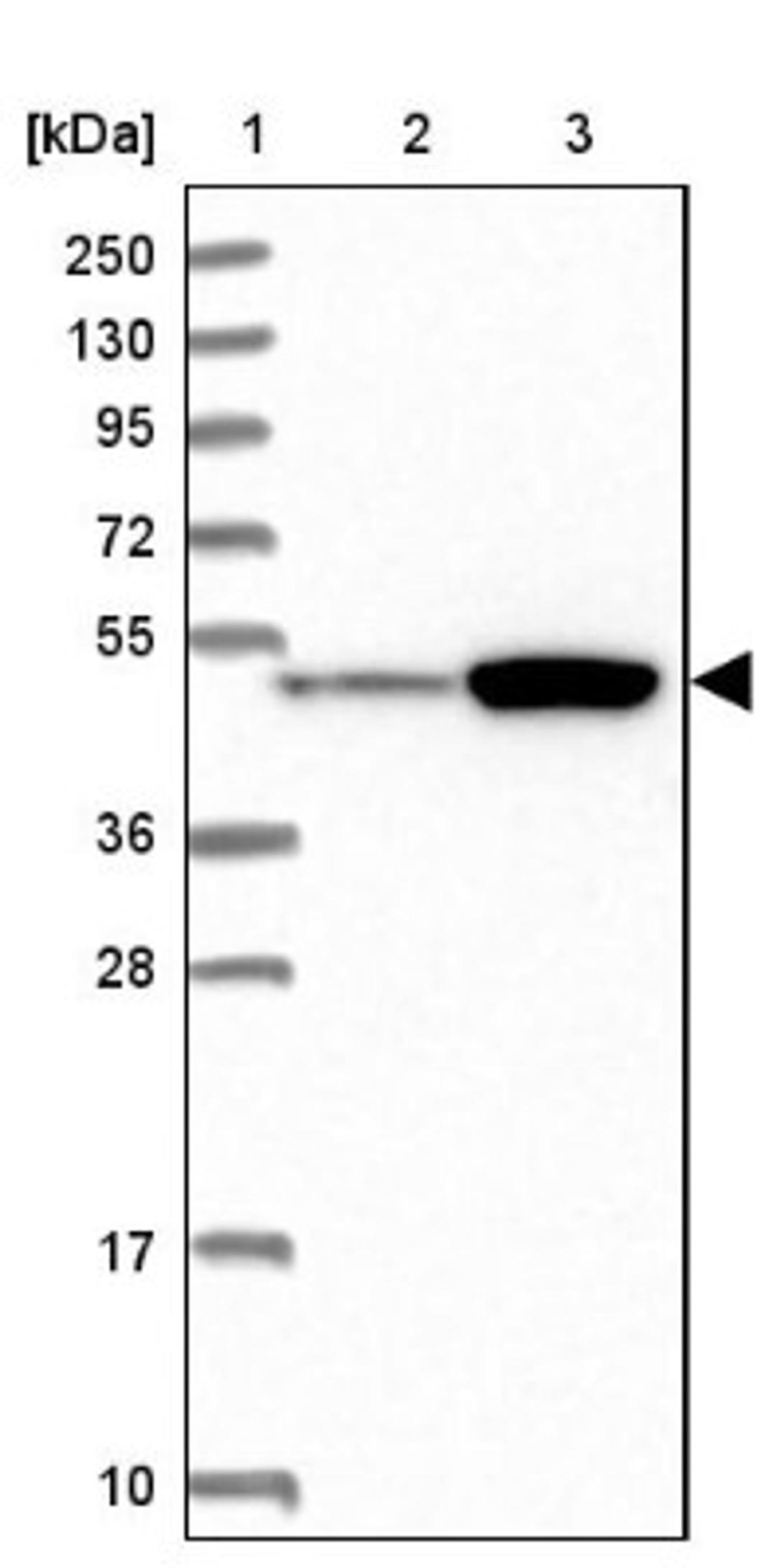 Western Blot: ATF7IP2 Antibody [NBP1-94029] - Lane 1: Marker [kDa] 250, 130, 95, 72, 55, 36, 28, 17, 10<br/>Lane 2: Human cell line RT-4<br/>Lane 3: Human cell line U-251MG sp