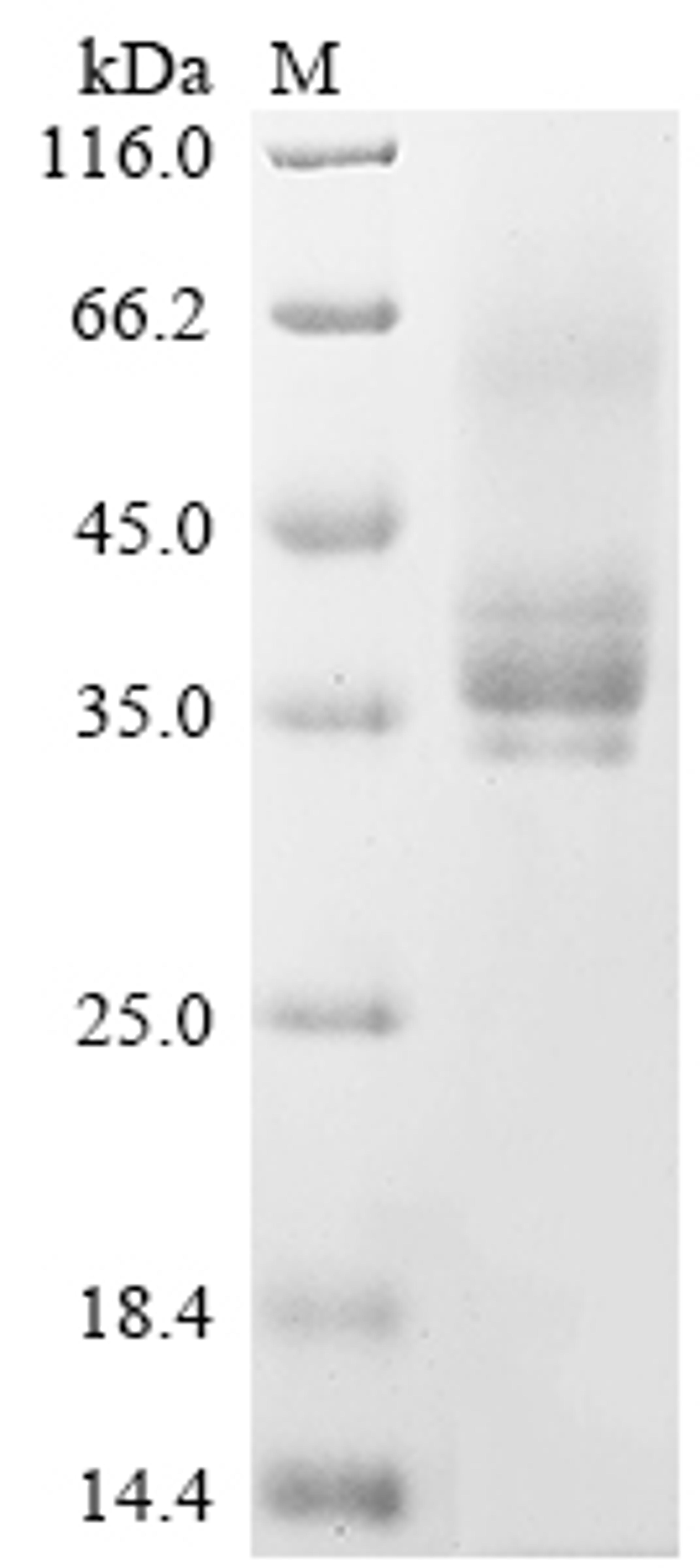 (Tris-Glycine gel) Discontinuous SDS-PAGE (reduced) with 5% enrichment gel and 15% separation gel.