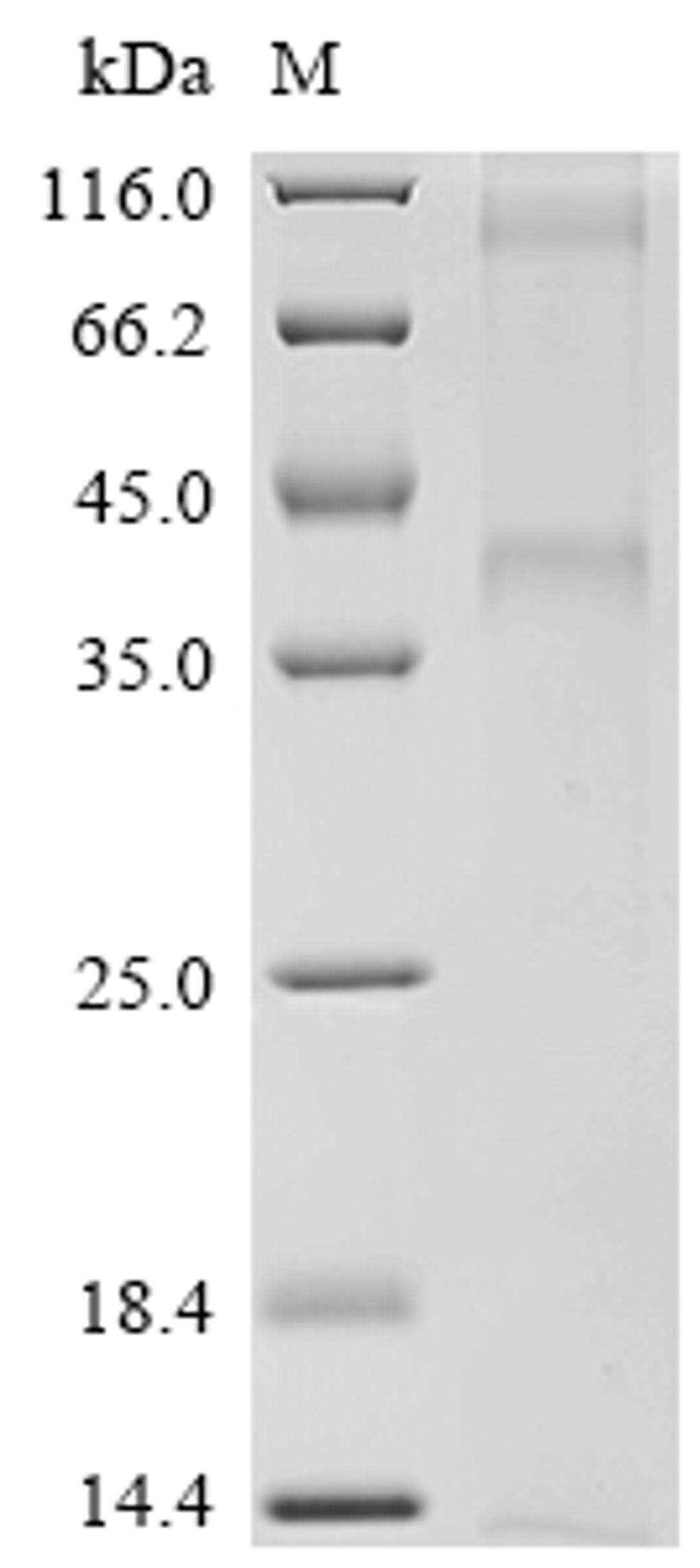 (Tris-Glycine gel) Discontinuous SDS-PAGE (reduced) with 5% enrichment gel and 15% separation gel.