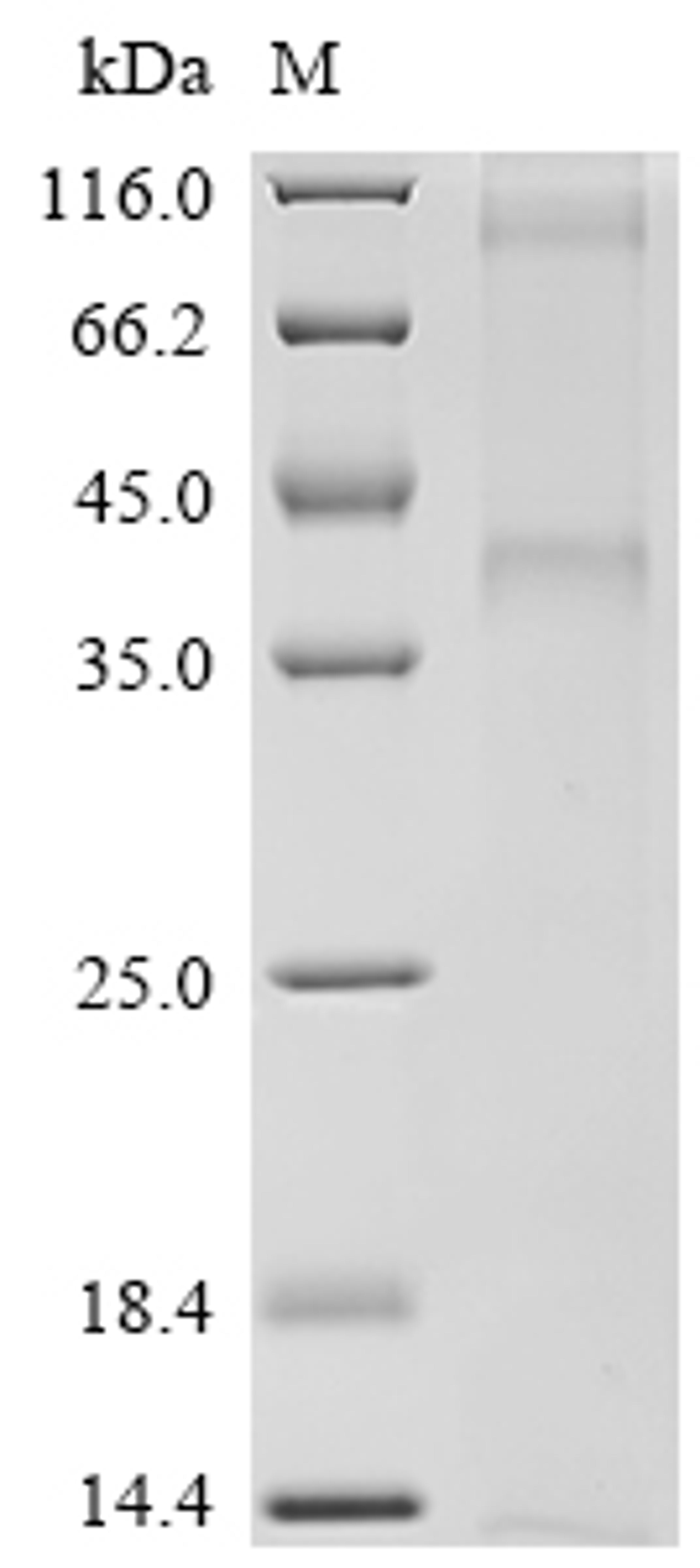 (Tris-Glycine gel) Discontinuous SDS-PAGE (reduced) with 5% enrichment gel and 15% separation gel.