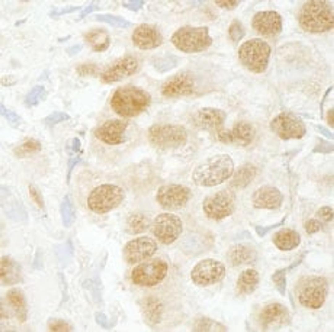 Detection of human SFRS2IP immunohistochemistry.