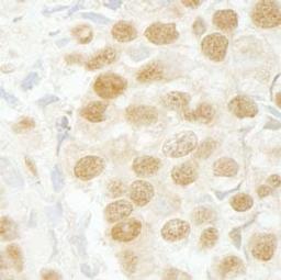 Detection of human SFRS2IP immunohistochemistry.