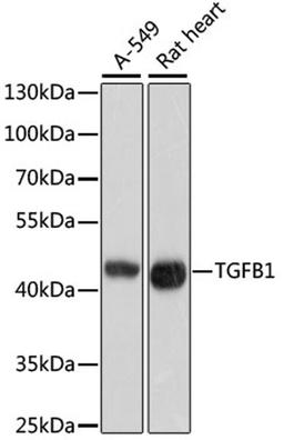 Western blot - TGFB1 antibody (A2124)