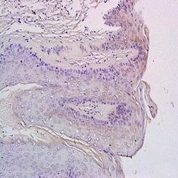 Immunohistochemical analysis of formalin-fixed and paraffin embedded rat exfoliated cells (Dilution at:1:200) using CXCR3 antibody