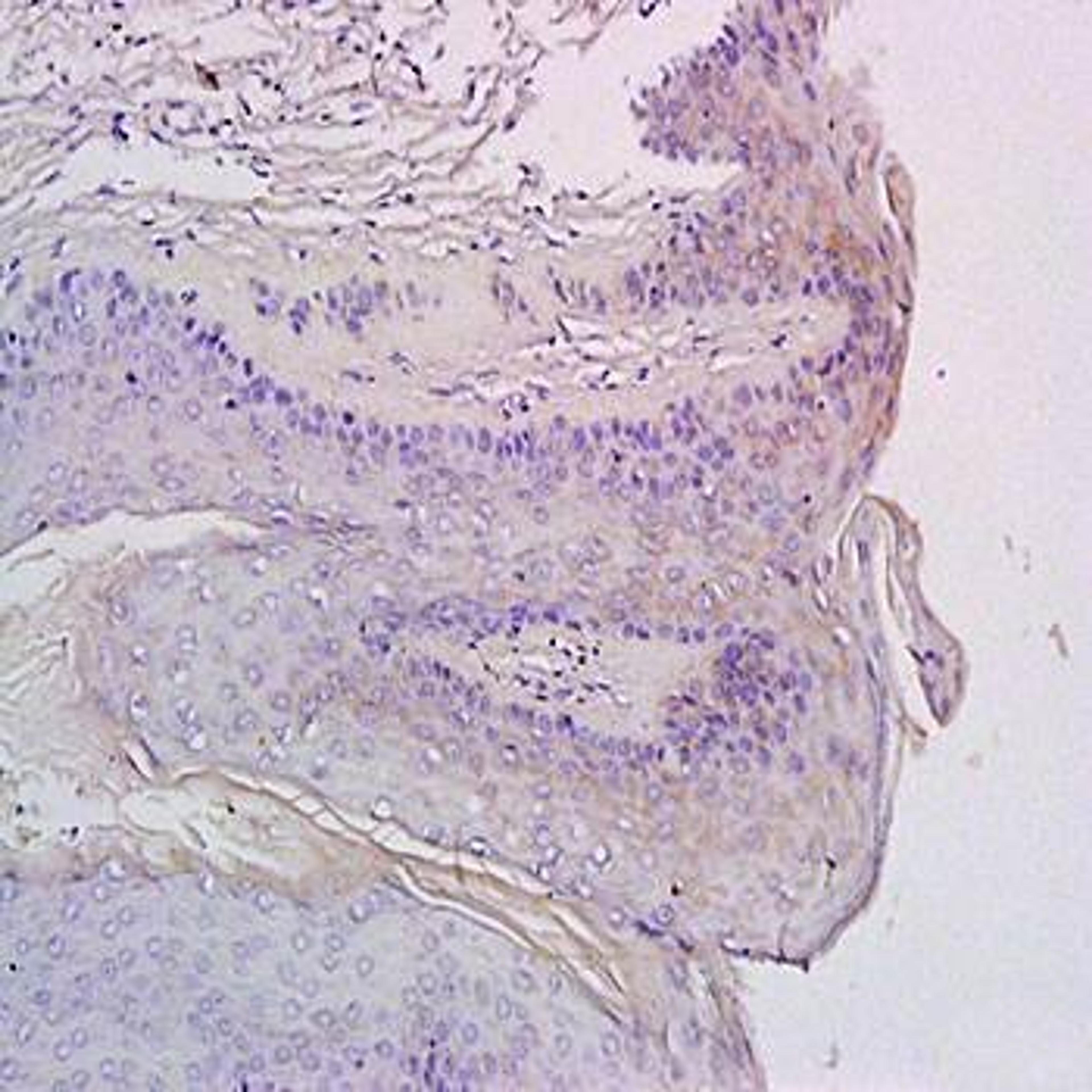 Immunohistochemical analysis of formalin-fixed and paraffin embedded rat exfoliated cells (Dilution at:1:200) using CXCR3 antibody