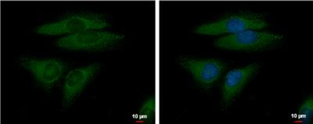 Immunocytochemistry/Immunofluorescence: FGF R5/FGFRL1 Antibody [NBP1-31461] - HeLa cells.