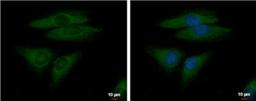 Immunocytochemistry/Immunofluorescence: FGF R5/FGFRL1 Antibody [NBP1-31461] - HeLa cells.