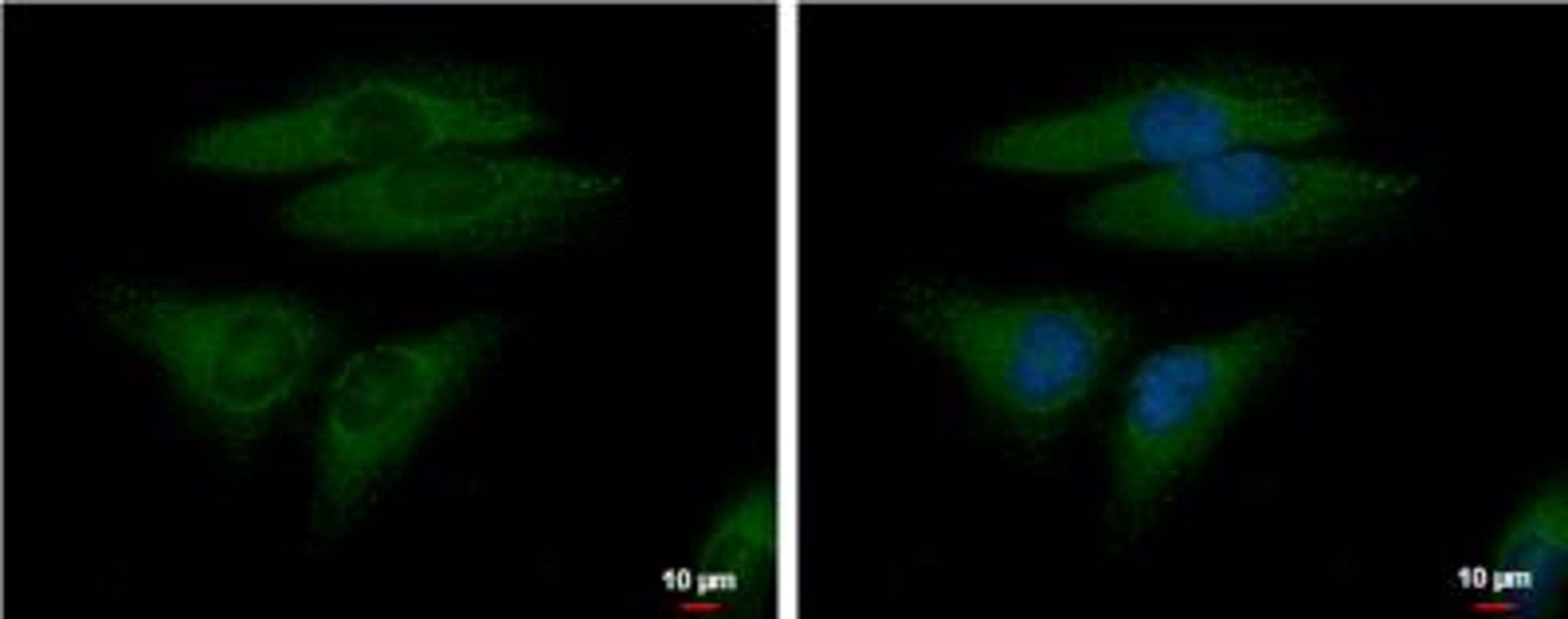 Immunocytochemistry/Immunofluorescence: FGF R5/FGFRL1 Antibody [NBP1-31461] - HeLa cells.