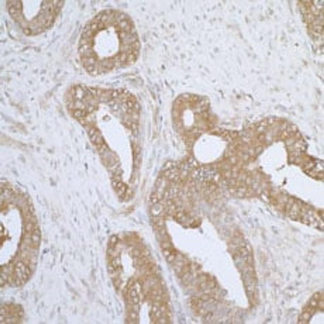 Detection of human AIMP1/EMAPII by immunohistochemistry.